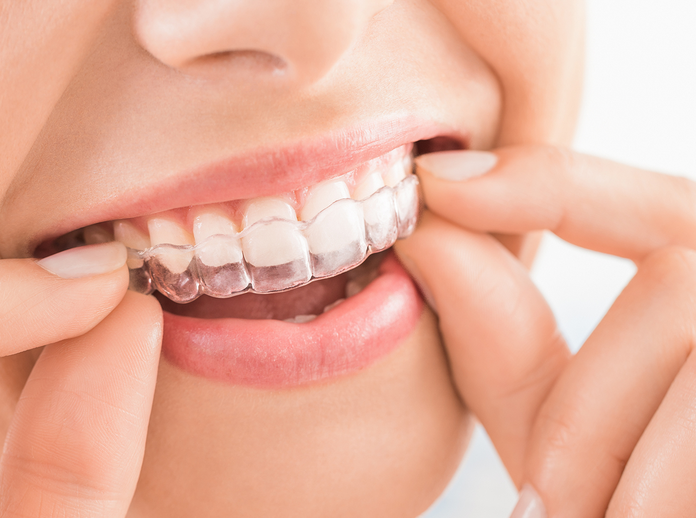 Beautiful smile and white teeth of a young woman.