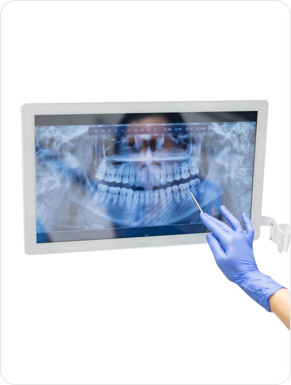 dental digital xray of teeth