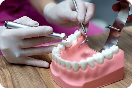 Implant-Supported Dentures