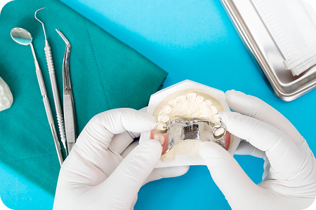 Partial Dentures