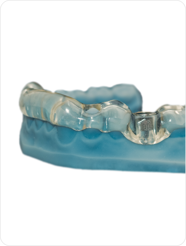 Surgical Dental Guides